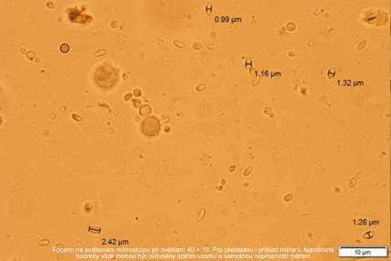 Obrázek Včely, mikrobiota a nosema